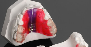 Aparatos removibles de Ortodoncia y Ortopedia maxilar