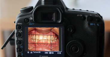 Curso básico de fotografía clínica odontológica
